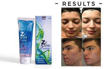Z Glow facewash for oily & acne prone skin (70 gm) (PACK OF 2)