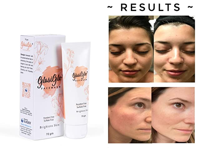 Glasiglo Facewash With Vitamin - C Removes dead skin cells & dark spots ( 70 ml ) (PACK OF 2)
