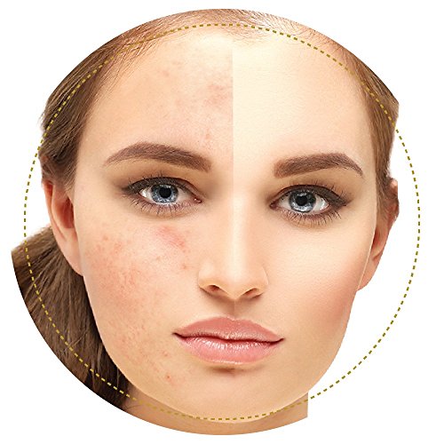 PAPENGLOW: FACE PACK FOR OILY SKIN 75gm.