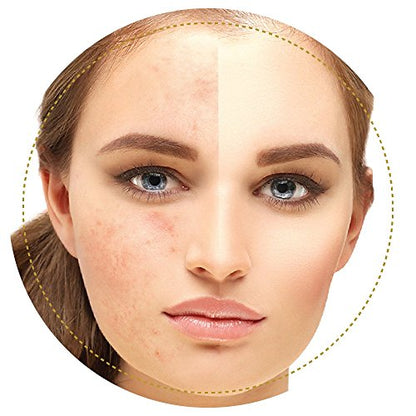PAPENGLOW: FACE PACK FOR OILY SKIN 75gm.
