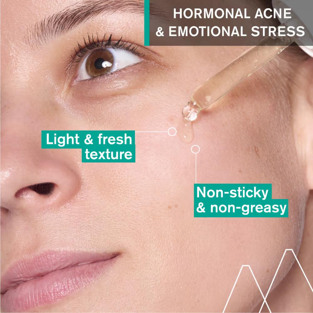 Uriage Hyseac Skin Anti-Blemish Serum 5.8% AHA for Hormonal Peak &amp; Stress Acne Dermat Recommended 30ML