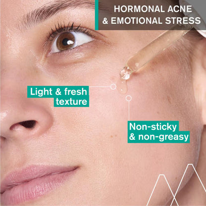 Uriage Hyseac Skin Anti-Blemish Serum 5.8% AHA for Hormonal Peak &amp; Stress Acne Dermat Recommended 30ML