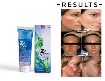 Z Glow facewash for oily & acne prone skin (70 gm) (PACK OF 2)