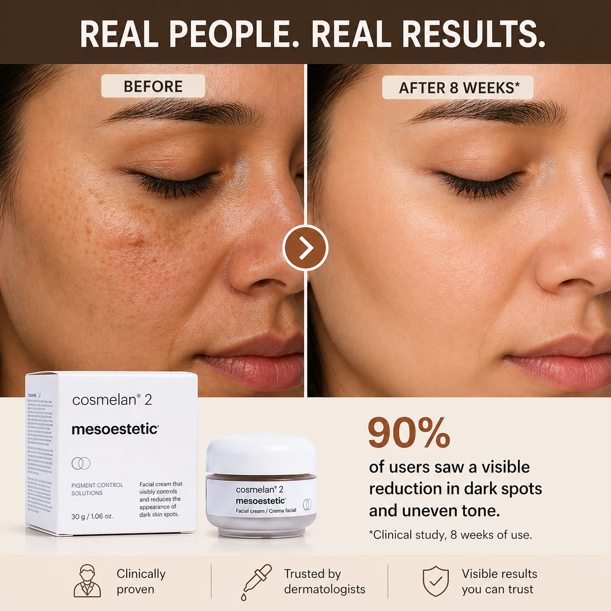Mesoestetic Cosmelan 2  Cream 30g
