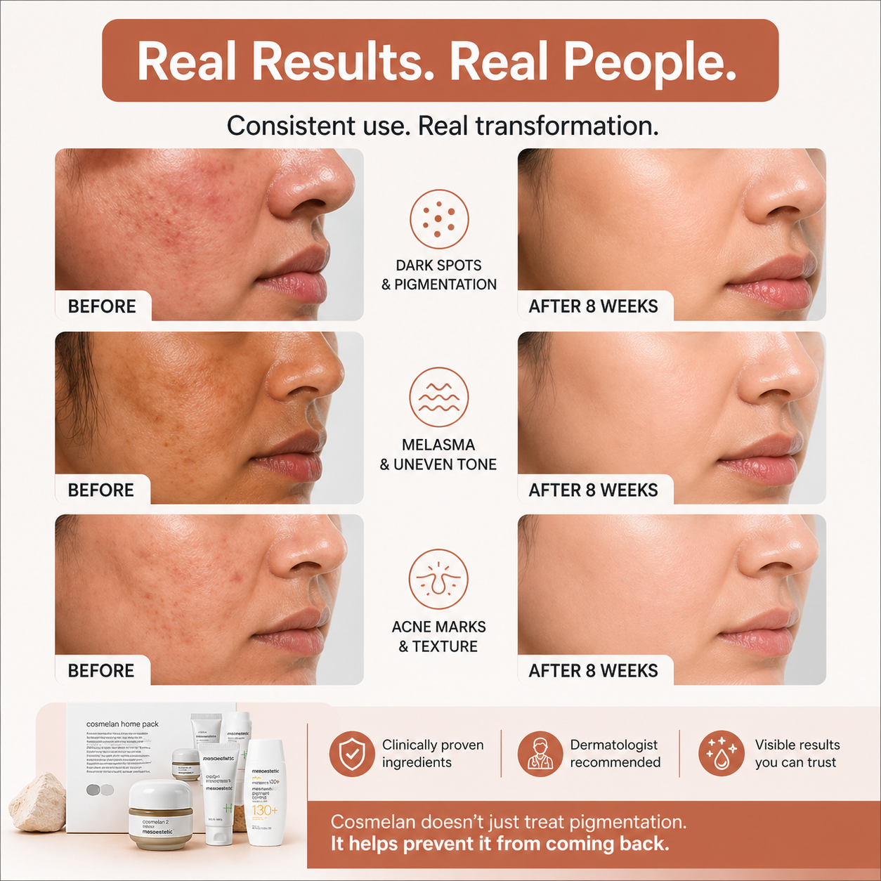 Mesoestetic Cosmelan Home Pack