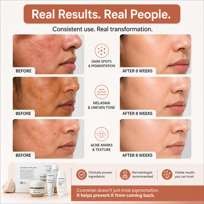 Mesoestetic Cosmelan Home Pack