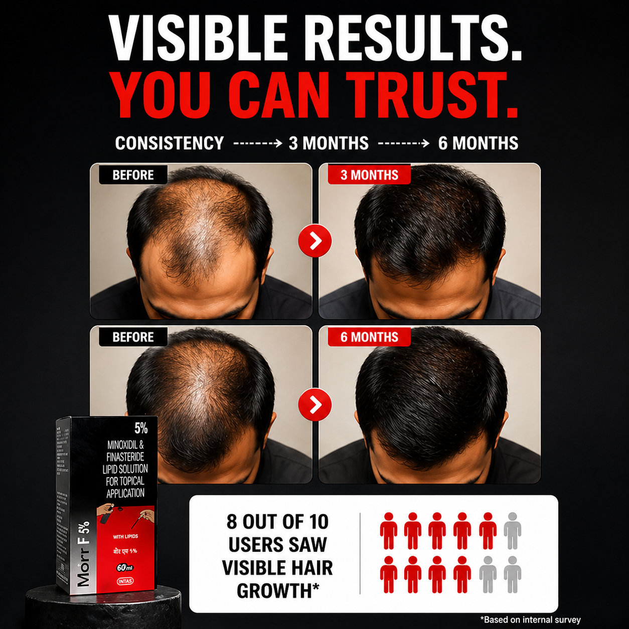 Morr F 5% hair  Solution