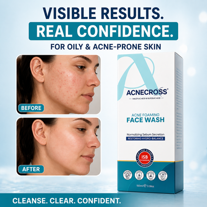 Acnecross Acne Foaming Face Wash 100ml