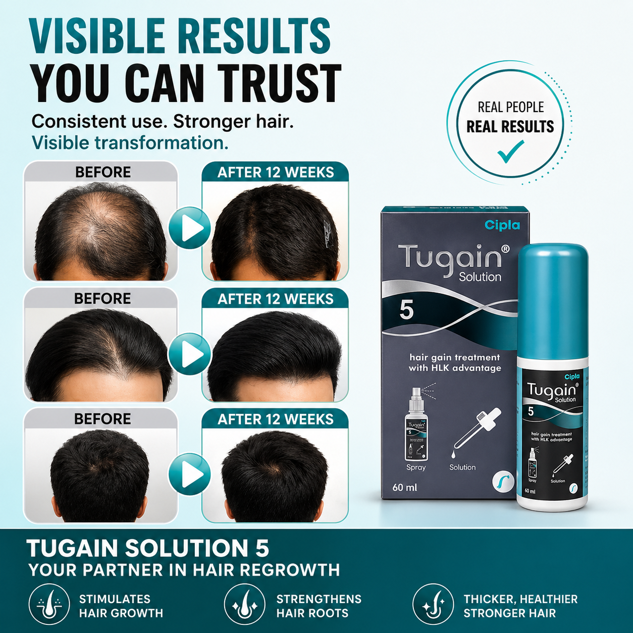 Tugain 5 solution 60ml