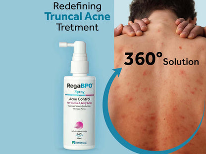 Rega-BPO Acne Control Body Spray 60ML