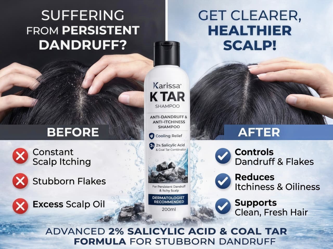 Karissa K TAR Anti-Dandruff Shampoo 200ML